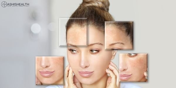 It May Protect Your Skin