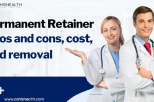 Permanent Retainer Pros and cons, cost, and removal