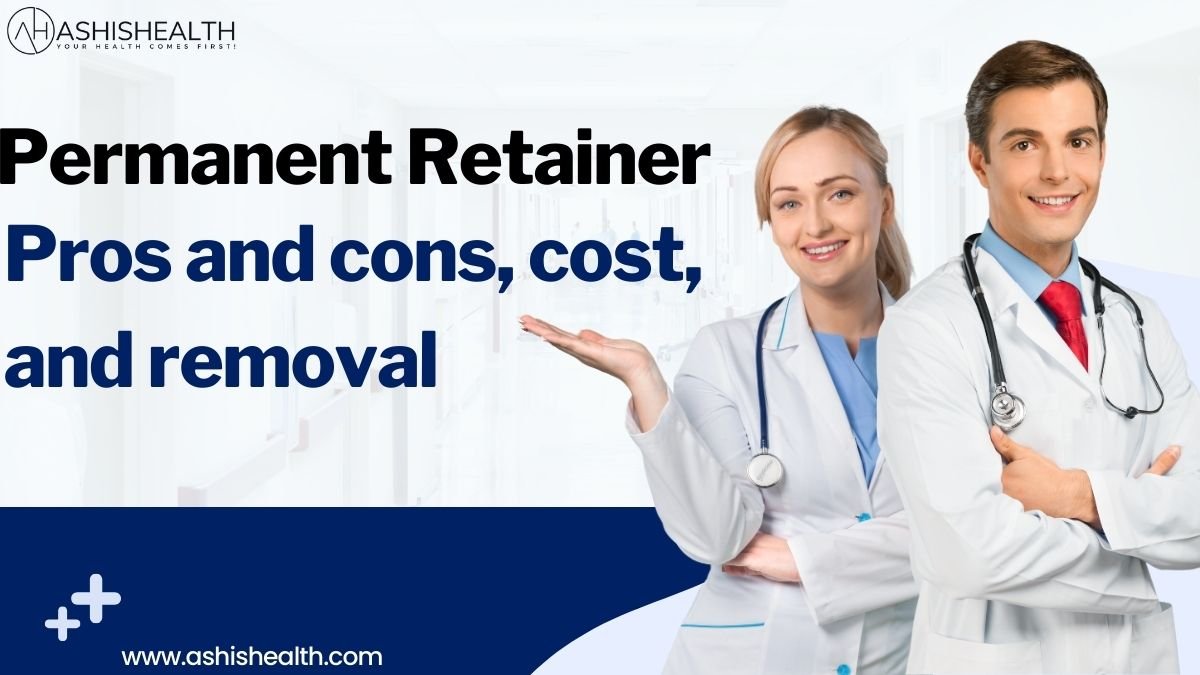 Permanent Retainer Pros and cons, cost, and removal