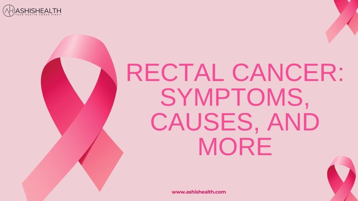 Rectal Cancer: Symptoms, Causes, and More