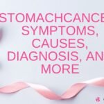 Stomach Cancer: Types, Symptoms, Treatment and more Stomach Cancer: Types, Symptoms, Treatment and more