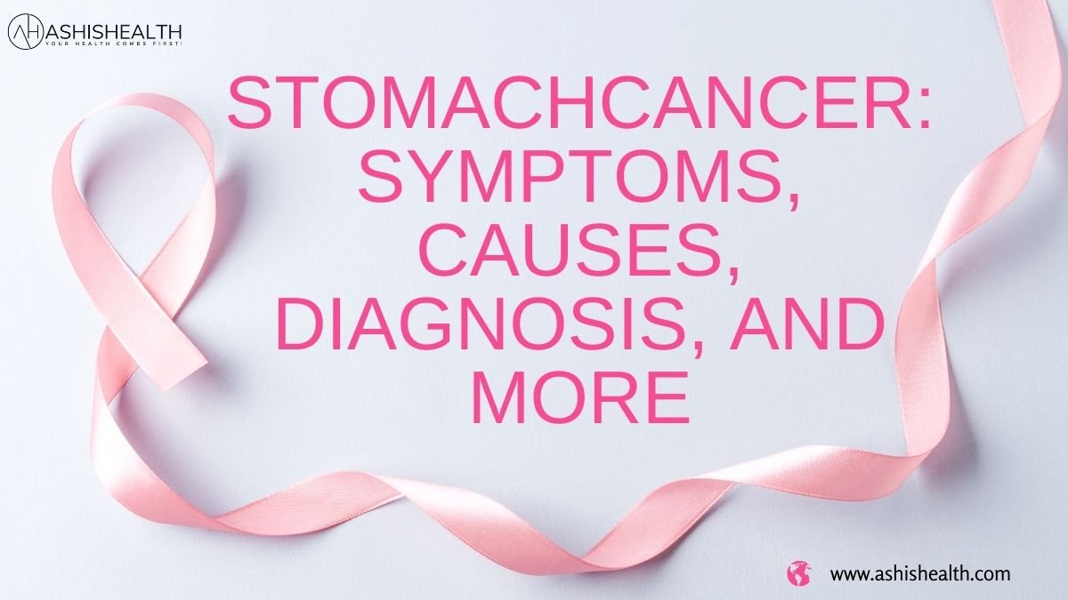 Stomach Cancer: Types, Symptoms, Treatment and more