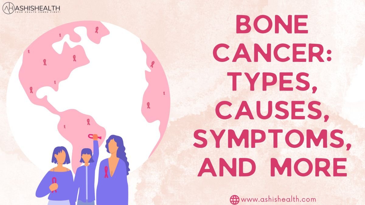 Bone Cancer: Types, Causes, Symptoms, and More