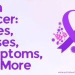 Brain Cancer: Types, Causes, Symptoms, and More Brain Cancer: Types, Causes, Symptoms, and More