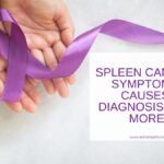 Spleen Cancer: Causes, Diagnosis, Symptoms and Treatment Spleen Cancer: Causes, Diagnosis, Symptoms and Treatment