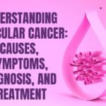 Testicular Cancer: Symptoms, Causes, Treatment and more Testicular Cancer: Symptoms, Causes, Treatment and more