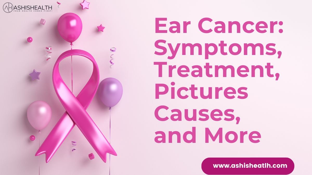 Ear cancer