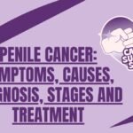 Penile Cancer: Symptoms, Causes, Diagnosis, Stages and Treatment penile cancer