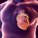 Heart Disease: Symptoms, Risk Factors and Treatment Heart Disease