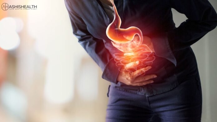 What is appendicitis?